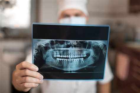 radiografía dental - hipoplasia dental